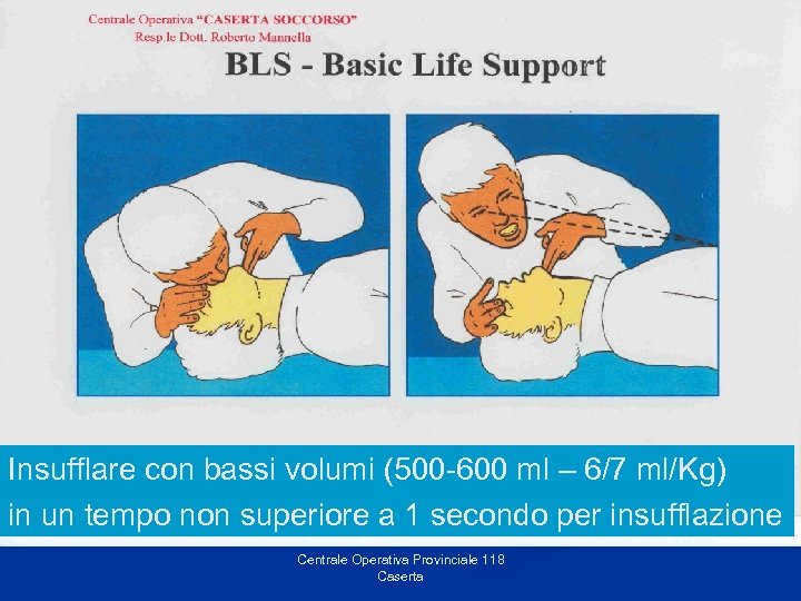 B = Breathing Insufflare con bassi volumi (500 -600 ml – 6/7 ml/Kg) in