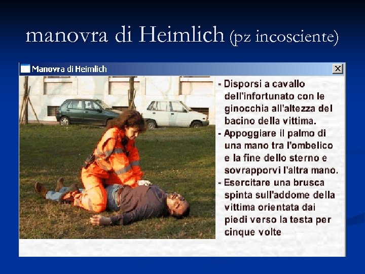 manovra di Heimlich (pz incosciente) 