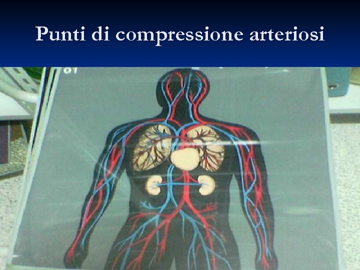 Punti di compressione arteriosi 