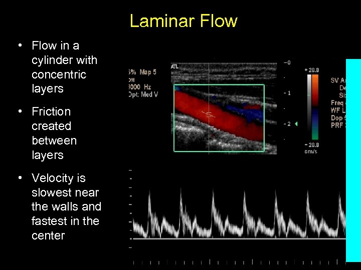 Laminar Flow • Flow in a cylinder with concentric layers • Friction created between
