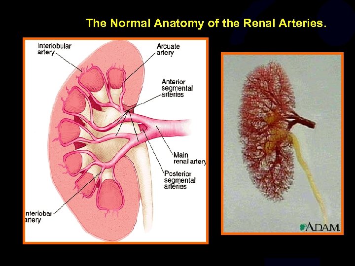 The Normal Anatomy of the Renal Arteries. 
