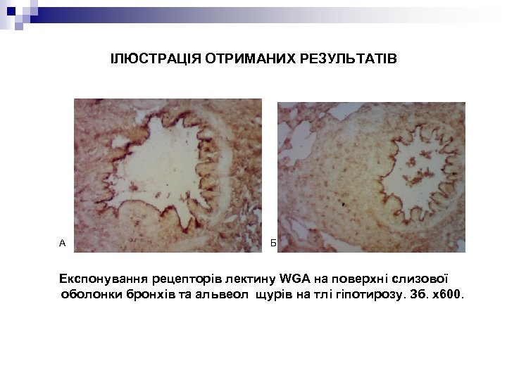 ІЛЮСТРАЦІЯ ОТРИМАНИХ РЕЗУЛЬТАТІВ А Б Експонування рецепторів лектину WGA на поверхні слизової оболонки бронхів