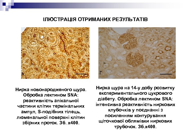 ІЛЮСТРАЦІЯ ОТРИМАНИХ РЕЗУЛЬТАТІВ Нирка новонародженого щура. Обробка лектином SNA: реактивність апікальної частини клітин термінальних