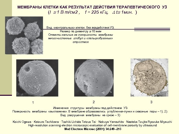 МЕМБРАНЫ КЛЕТКИ КАК РЕЗУЛЬТАТ ДЕЙСТВИЯ ТЕРАПЕВТИЧЕСКОГО УЗ (I 1 В т/см 2 , f