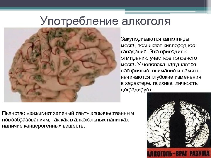 Употребление алкоголя Закупориваются капилляры мозга, возникает кислородное голодание. Это приводит к отмиранию участков головного