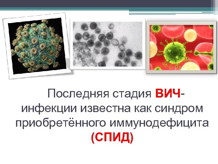 Последняя стадия ВИЧинфекции известна как синдром приобретённого иммунодефицита (СПИД) 