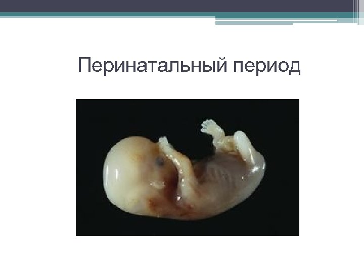 Перинатальный период 