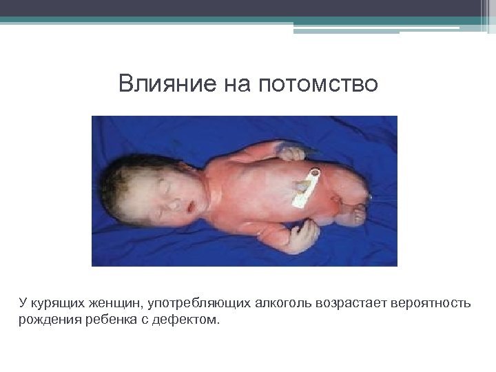 Влияние на потомство У курящих женщин, употребляющих алкоголь возрастает вероятность рождения ребенка с дефектом.