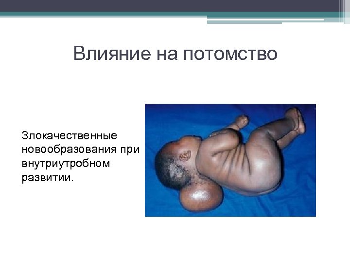 Влияние на потомство Злокачественные новообразования при внутриутробном развитии. 