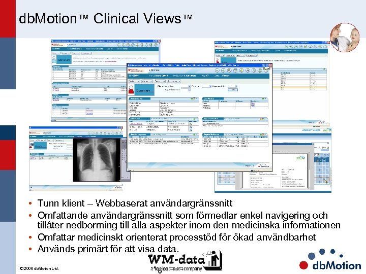 db. Motion™ Clinical Views™ • Tunn klient – Webbaserat användargränssnitt • Omfattande användargränssnitt som