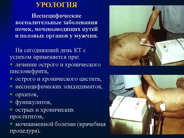 УРОЛОГИЯ Неспецифические воспалительные заболевания почек, мочевыводящих путей и половых органов у мужчин. На сегодняшний