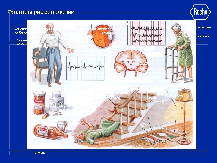 Факторы риска падений Внутренние факторы Сердечно-сосудистые заболевания Постуральная Глаукома Мышечная гипотензия дистрофия Сердечные болезни