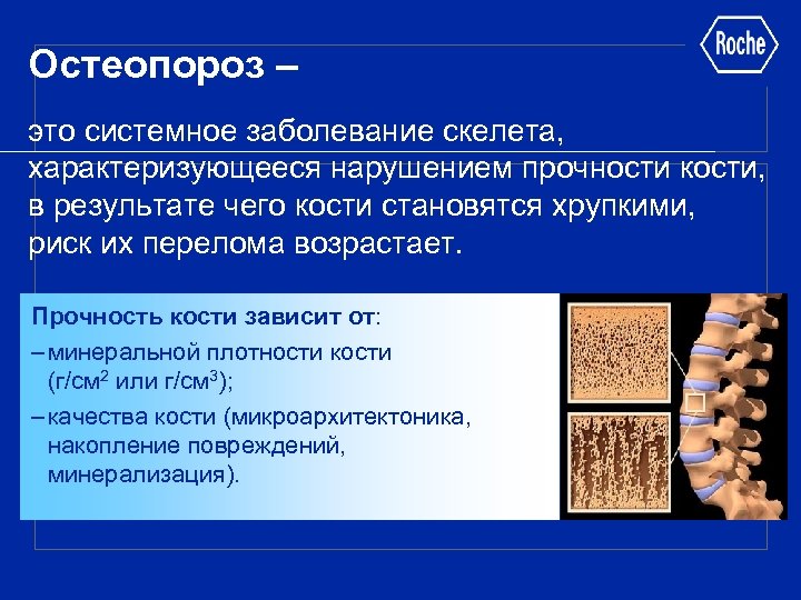 Остеопороз – это системное заболевание скелета, характеризующееся нарушением прочности кости, в результате чего кости