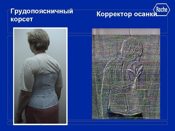 Грудопоясничный корсет Корректор осанки 