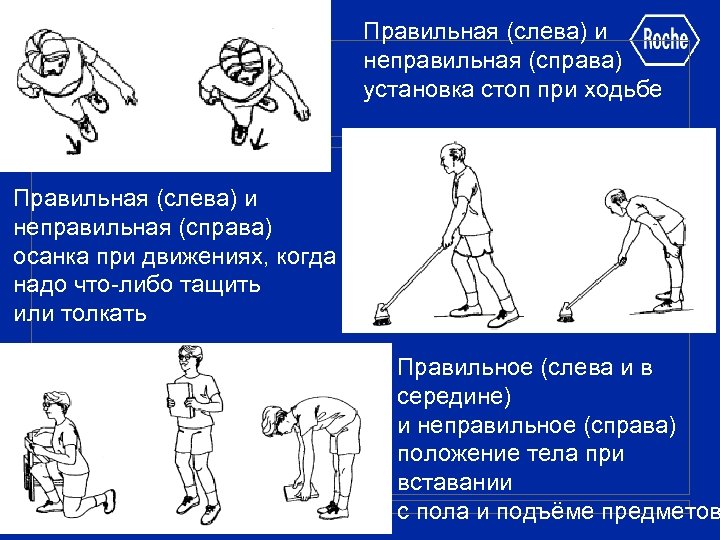 Правильная (слева) и неправильная (справа) установка стоп при ходьбе Правильная (слева) и неправильная (справа)