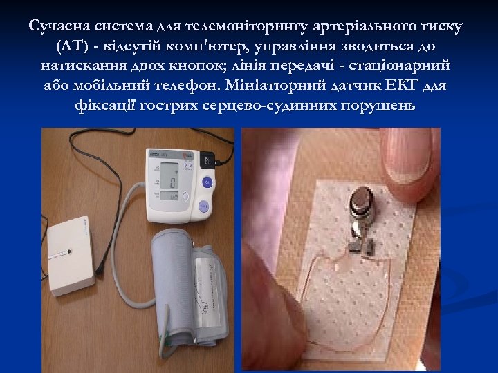 Сучасна система для телемоніторингу артеріального тиску (АТ) - відсутій комп'ютер, управління зводиться до натискання