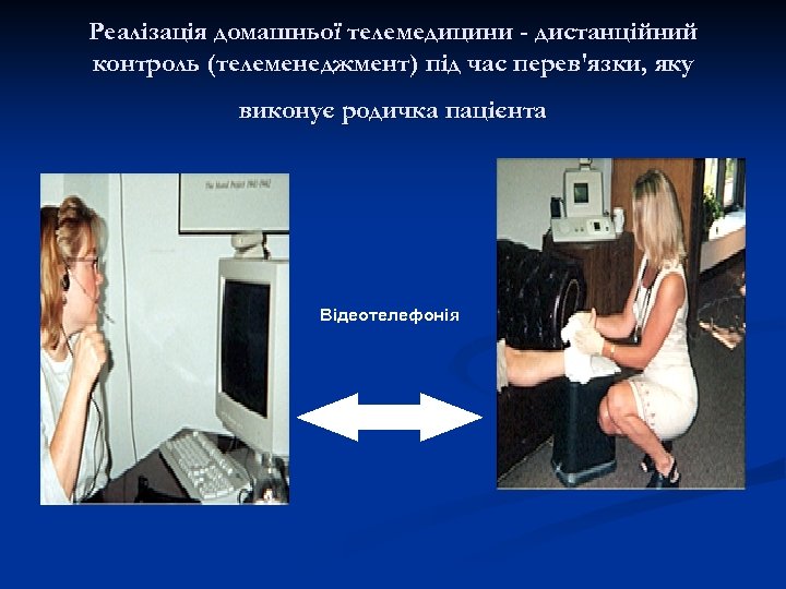 Реалізація домашньої телемедицини - дистанційний контроль (телеменеджмент) під час перев'язки, яку виконує родичка пацієнта
