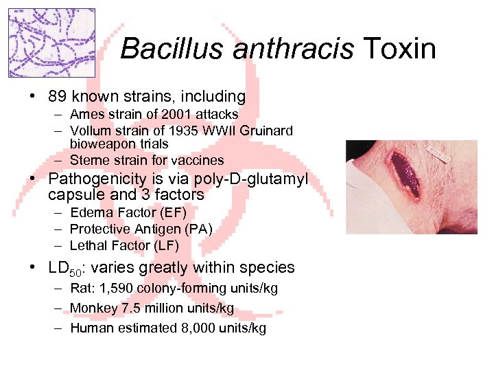 Bacillus anthracis Toxin • 89 known strains, including – Ames strain of 2001 attacks