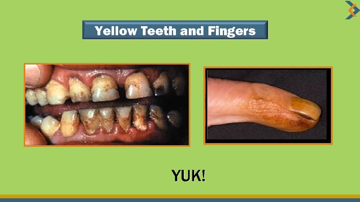 Yellow Teeth and Fingers YUK! 