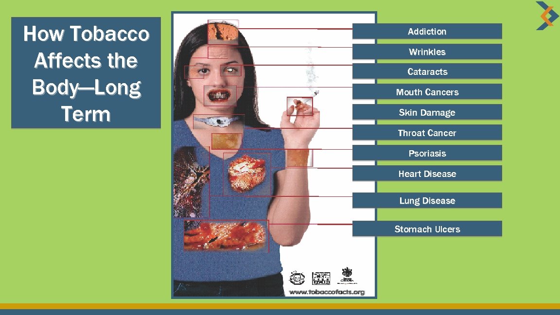 How Tobacco Affects the Body—Long Term Addiction Wrinkles Cataracts Mouth Cancers Skin Damage Throat