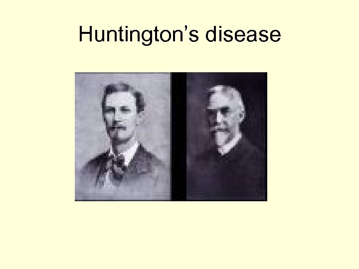 Huntington’s disease 