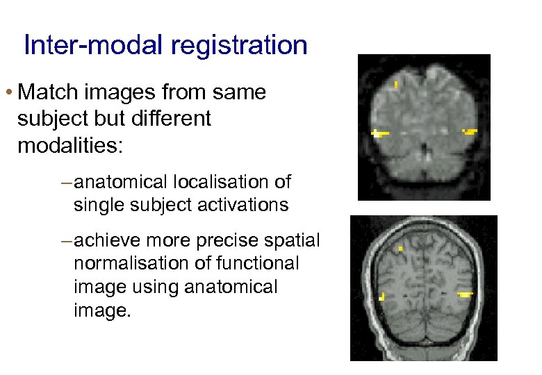 Inter-modal registration • Match images from same subject but different modalities: – anatomical localisation