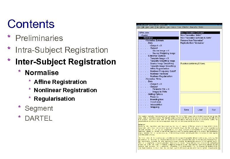 Contents * Preliminaries * Intra-Subject Registration * Inter-Subject Registration * Normalise * Affine Registration