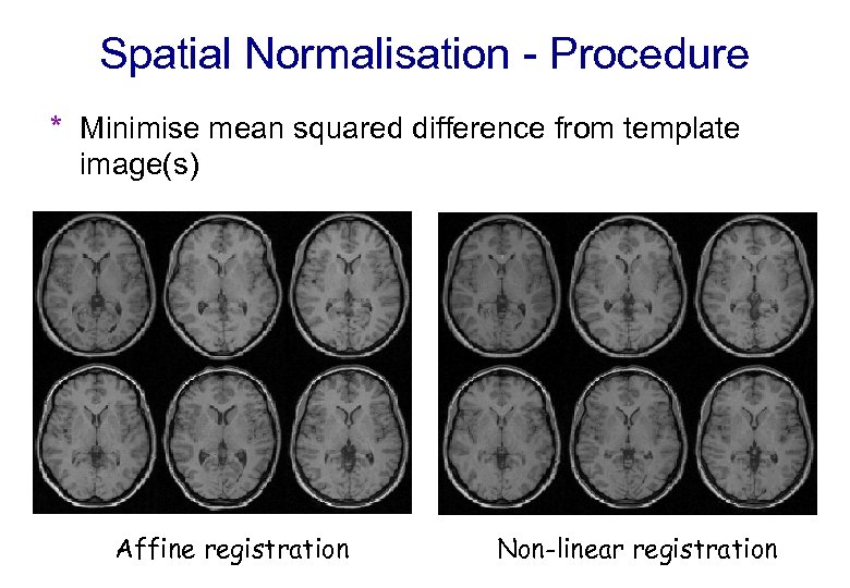 Spatial Normalisation - Procedure * Minimise mean squared difference from template image(s) Affine registration