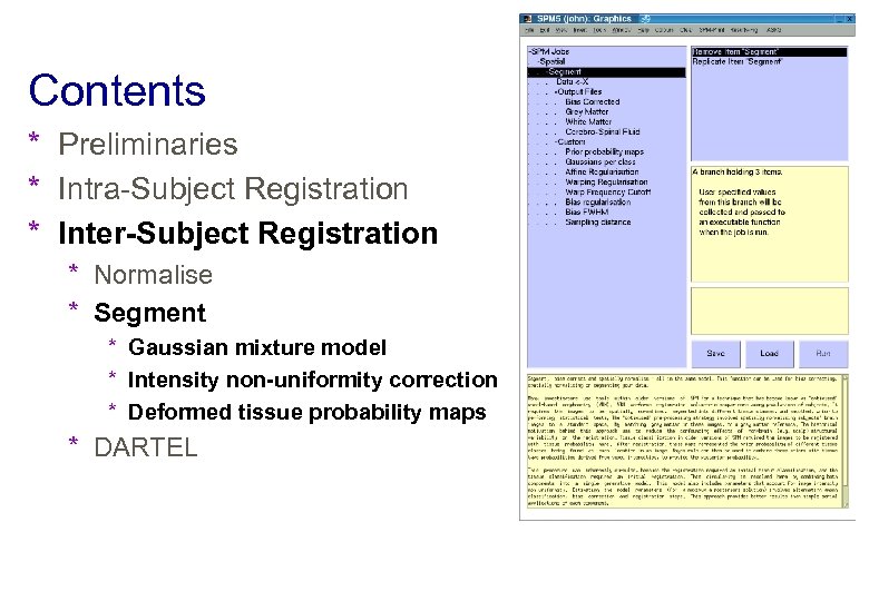 Contents * Preliminaries * Intra-Subject Registration * Inter-Subject Registration * Normalise * Segment *