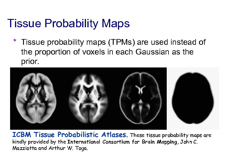 Tissue Probability Maps * Tissue probability maps (TPMs) are used instead of the proportion