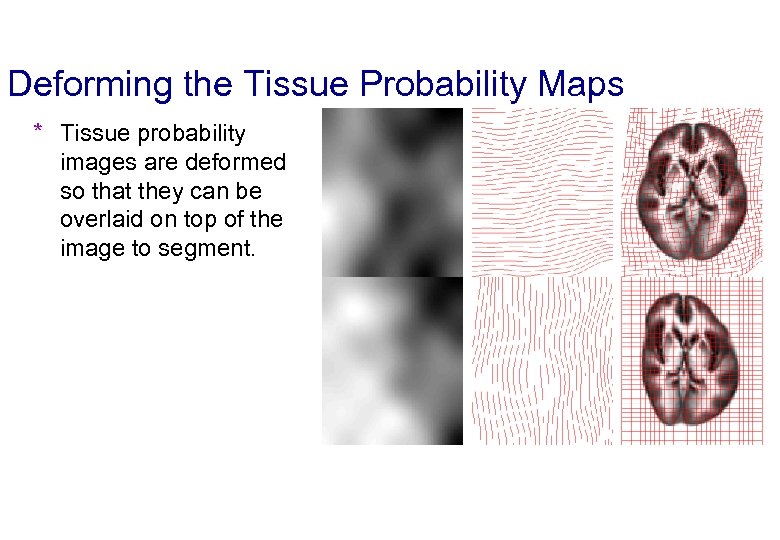 Deforming the Tissue Probability Maps * Tissue probability images are deformed so that they