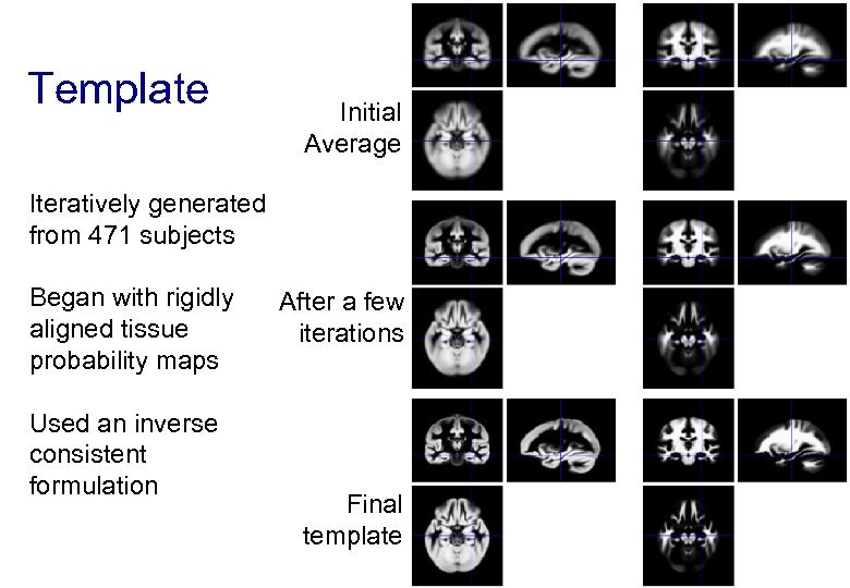 Template Initial Average Iteratively generated from 471 subjects Began with rigidly aligned tissue probability