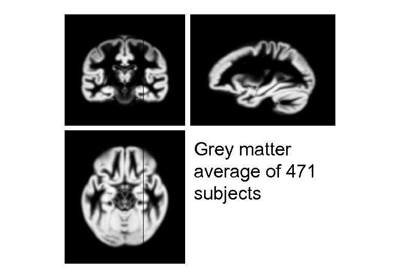 Grey matter average of 471 subjects 