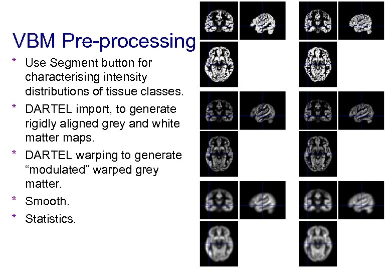 VBM Pre-processing * Use Segment button for characterising intensity distributions of tissue classes. *