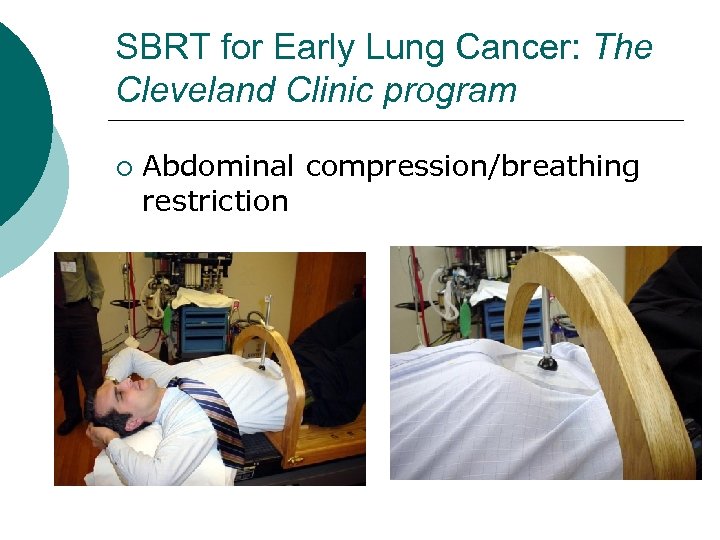 SBRT for Early Lung Cancer: The Cleveland Clinic program ¡ Abdominal compression/breathing restriction 