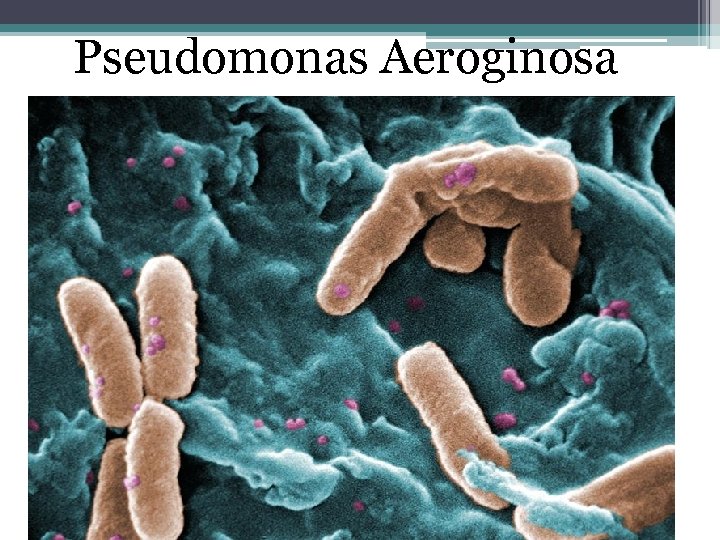 Pseudomonas Aeroginosa 