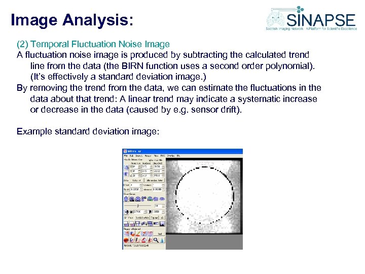 Image Analysis: (2) Temporal Fluctuation Noise Image A fluctuation noise image is produced by