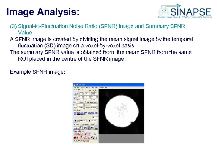 Image Analysis: (3) Signal-to-Fluctuation Noise Ratio (SFNR) Image and Summary SFNR Value A SFNR
