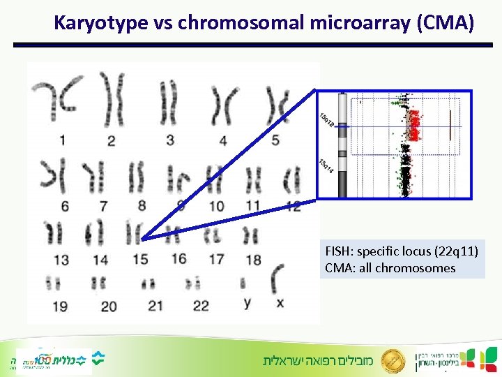 Karyotype vs chromosomal microarray (CMA) FISH: specific locus (22 q 11) CMA: all chromosomes