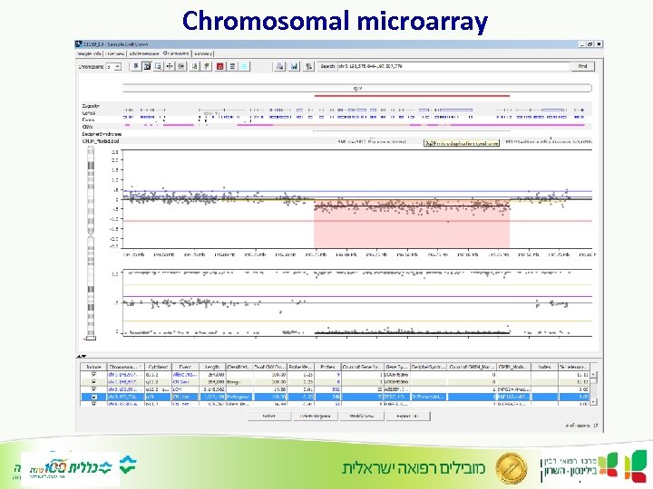 Chromosomal microarray 