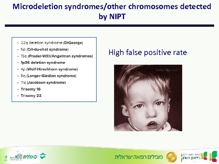 Microdeletion syndromes/other chromosomes detected by NIPT High false positive rate 