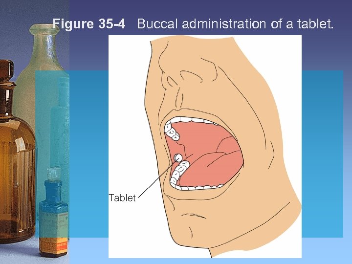Figure 35 -4 Buccal administration of a tablet. 