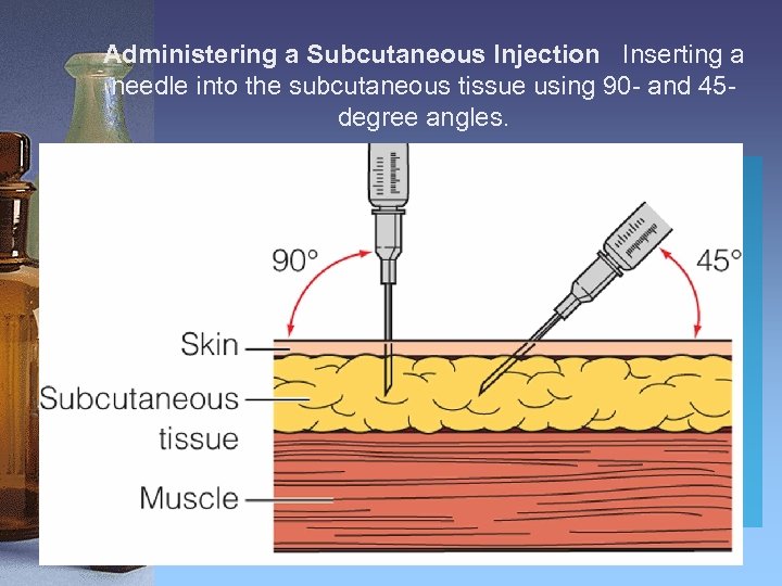 Administering a Subcutaneous Injection Inserting a needle into the subcutaneous tissue using 90 -
