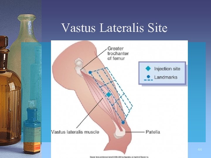 Vastus Lateralis Site 44 