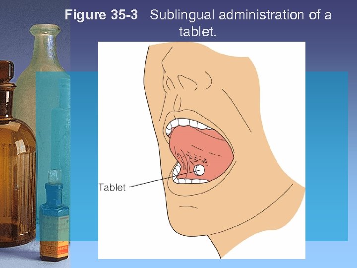 Figure 35 -3 Sublingual administration of a tablet. 