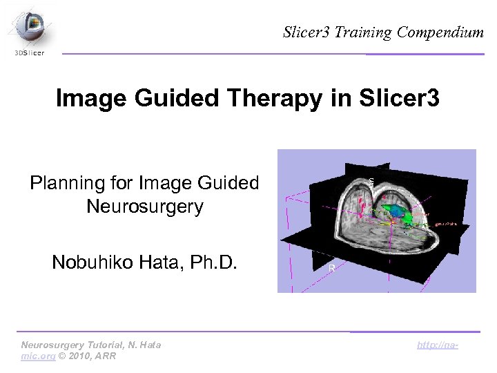 Slicer 3 Training Compendium Image Guided Therapy in Slicer 3 Planning for Image Guided