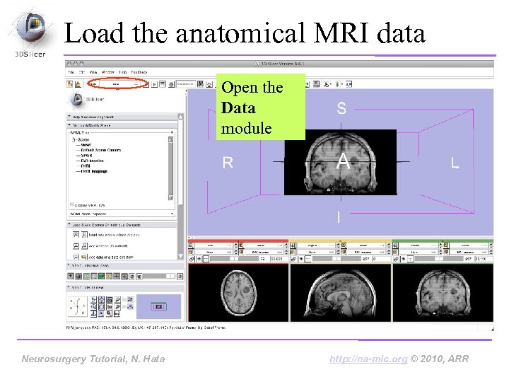 Load the anatomical MRI data Open the Data module Neurosurgery Tutorial, N. Hata http: