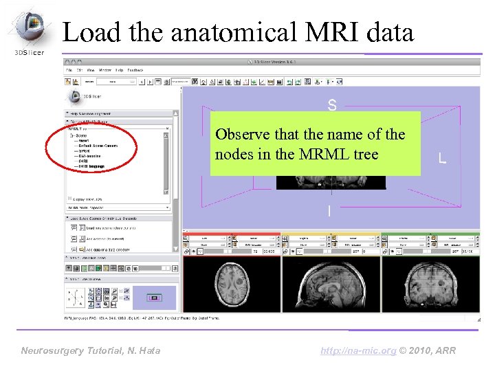 Load the anatomical MRI data Observe that the name of the nodes in the