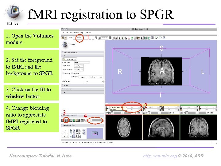 f. MRI registration to SPGR 1. Open the Volumes module 1 2. Set the