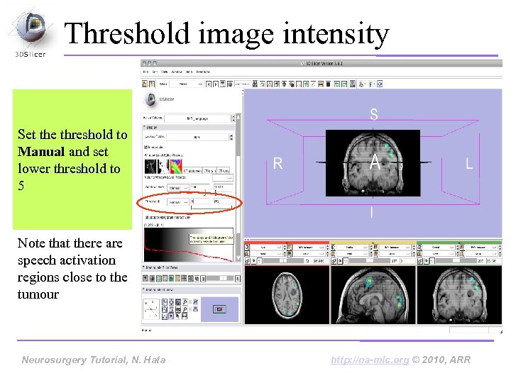 Threshold image intensity Set the threshold to Manual and set lower threshold to 5